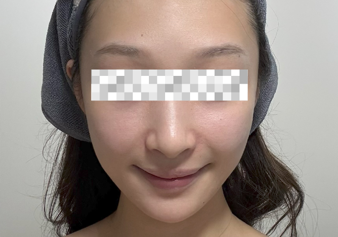 After